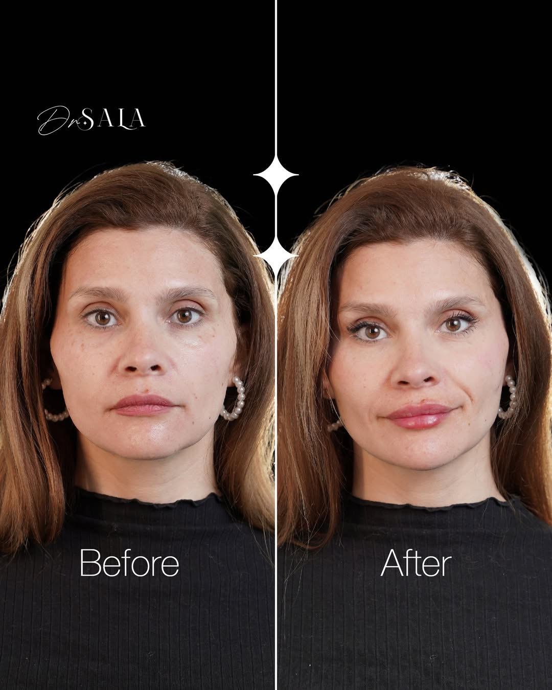 حالة قبل وبعد 2